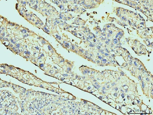 Annexin A6 Antibody in Immunohistochemistry (Paraffin) (IHC (P))