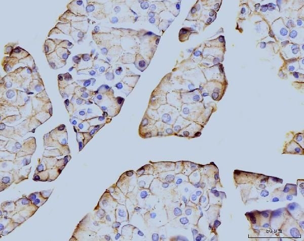 Annexin A6 Antibody in Immunohistochemistry (Paraffin) (IHC (P))