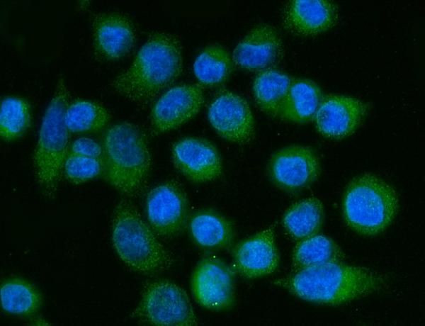 ACSL4 Antibody in Immunocytochemistry (ICC/IF)