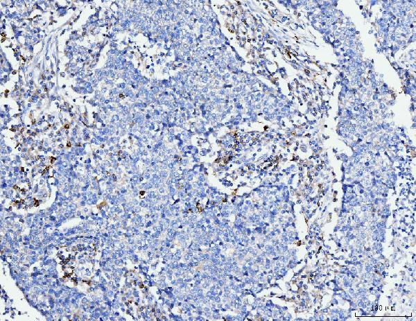 ACSL4 Antibody in Immunohistochemistry (Paraffin) (IHC (P))