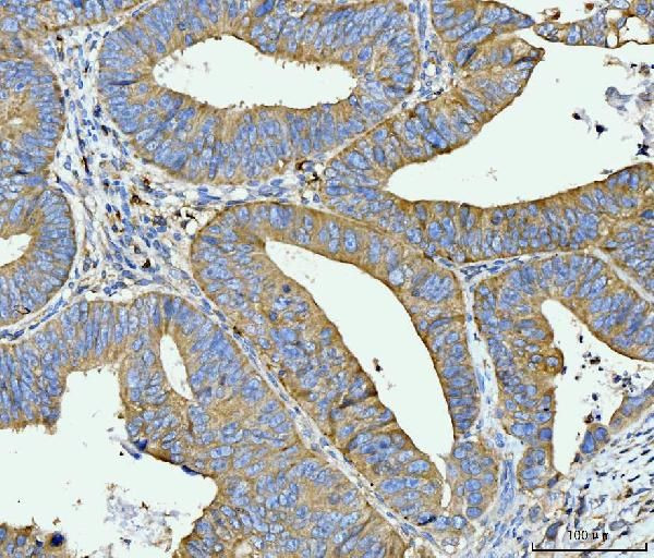 ACSL4 Antibody in Immunohistochemistry (Paraffin) (IHC (P))