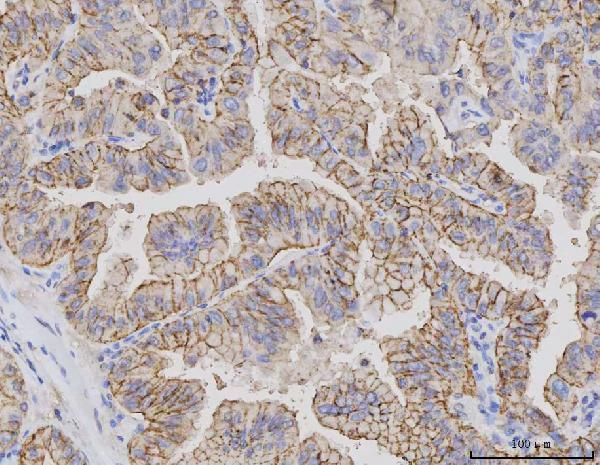 Claudin 3 Antibody in Immunohistochemistry (Paraffin) (IHC (P))