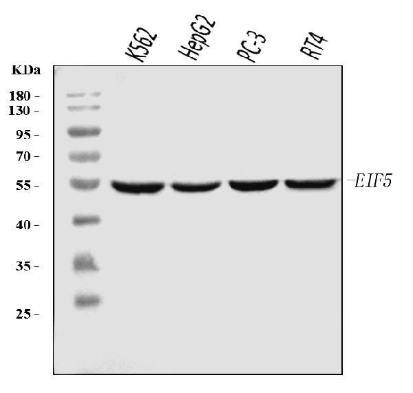 eIF5 Antibody in Western Blot (WB)