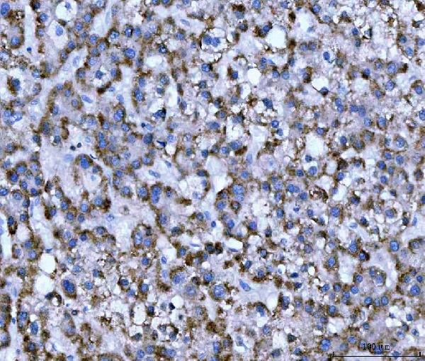 WDR1 Antibody in Immunohistochemistry (Paraffin) (IHC (P))