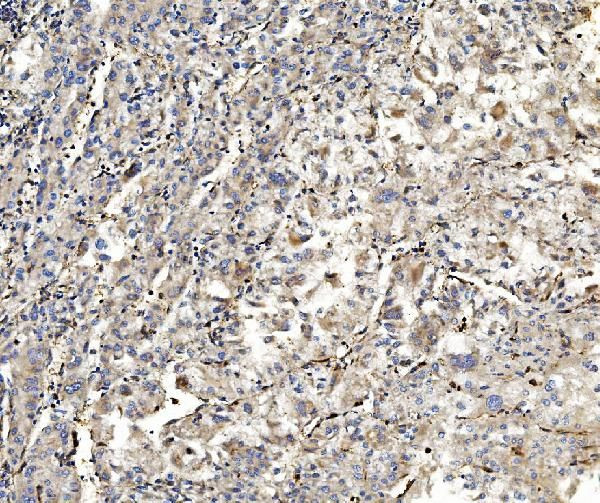 Aldolase A Antibody in Immunohistochemistry (Paraffin) (IHC (P))