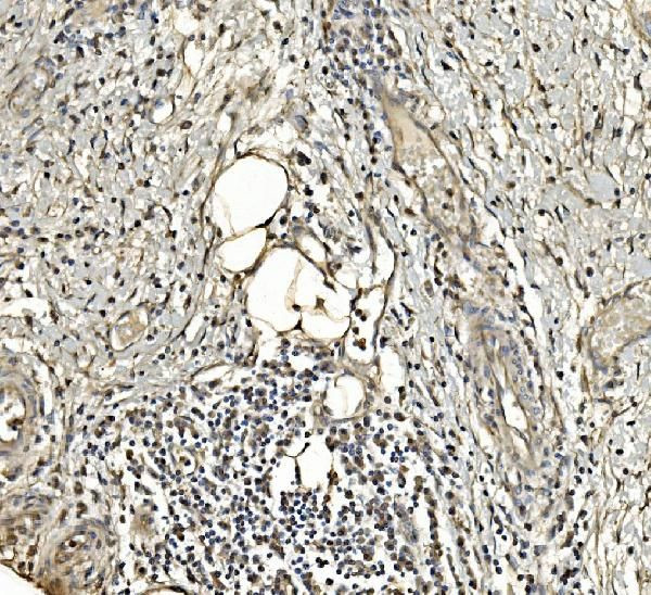 Aldolase A Antibody in Immunohistochemistry (Paraffin) (IHC (P))