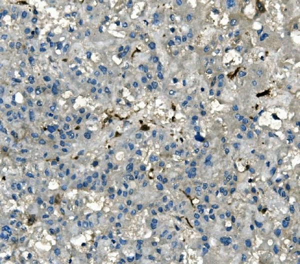 AKR1D1 Antibody in Immunohistochemistry (Paraffin) (IHC (P))