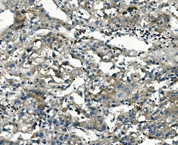 AKR1D1 Antibody in Immunohistochemistry (Paraffin) (IHC (P))