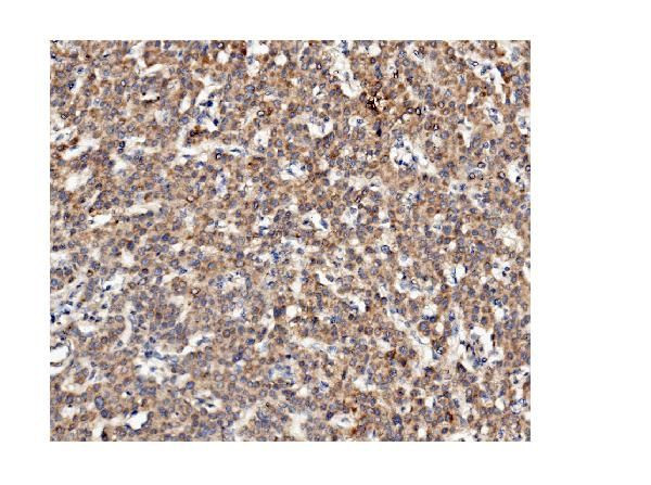 CKAP5 Antibody in Immunohistochemistry (Paraffin) (IHC (P))