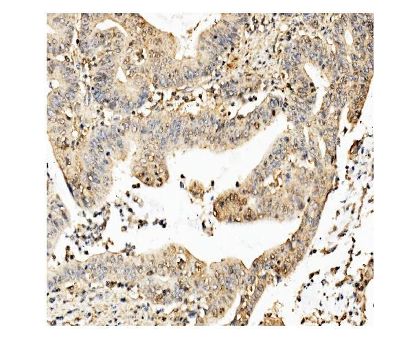 CKAP5 Antibody in Immunohistochemistry (Paraffin) (IHC (P))