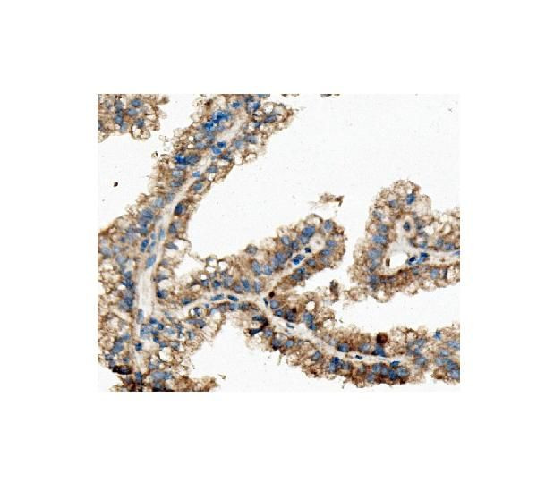 CKAP5 Antibody in Immunohistochemistry (Paraffin) (IHC (P))