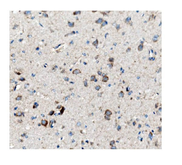 CKAP5 Antibody in Immunohistochemistry (Paraffin) (IHC (P))