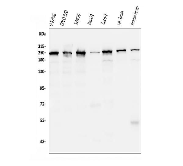 CKAP5 Antibody in Western Blot (WB)