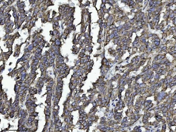 Drebrin Antibody in Immunohistochemistry (Paraffin) (IHC (P))