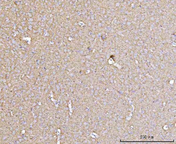 Drebrin Antibody in Immunohistochemistry (Paraffin) (IHC (P))