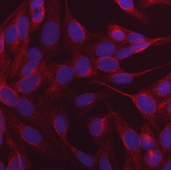 CALCOCO2 Antibody in Immunocytochemistry (ICC/IF)