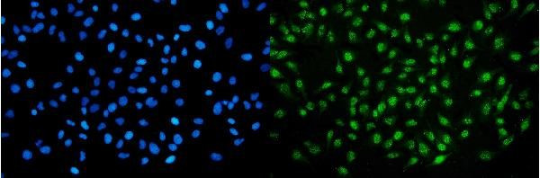 UHRF2 Antibody in Immunocytochemistry (ICC/IF)