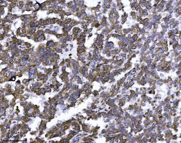 ERLIN2 Antibody in Immunohistochemistry (Paraffin) (IHC (P))