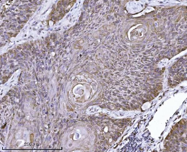 ERLIN2 Antibody in Immunohistochemistry (Paraffin) (IHC (P))