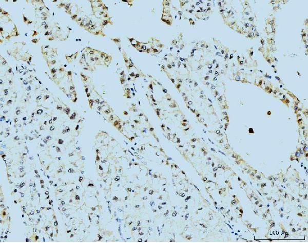 PSMC3 Antibody in Immunohistochemistry (Paraffin) (IHC (P))