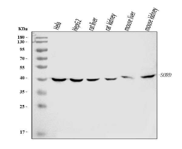 Sorbitol Dehydrogenase Antibody in Western Blot (WB)