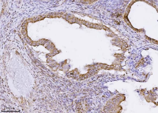 PMPCB Antibody in Immunohistochemistry (Paraffin) (IHC (P))