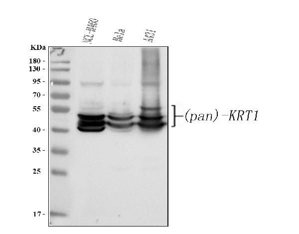 pan Keratin Antibody in Western Blot (WB)