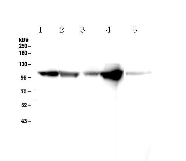 alpha Actinin 2 Antibody in Western Blot (WB)