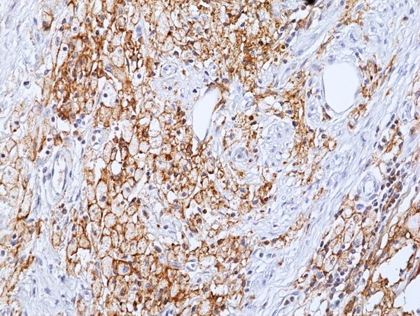 LAIR1 Antibody in Immunohistochemistry (Paraffin) (IHC (P))