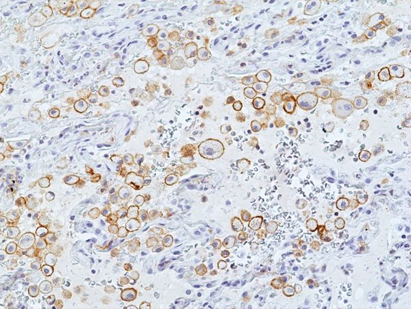 LAIR1 Antibody in Immunohistochemistry (Paraffin) (IHC (P))