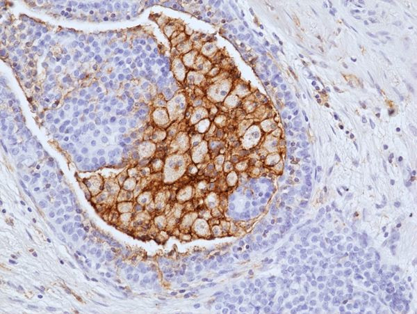 LAIR1 Antibody in Immunohistochemistry (Paraffin) (IHC (P))