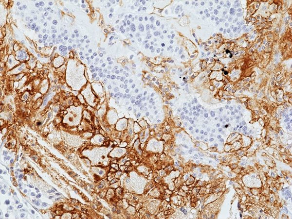 LAIR1 Antibody in Immunohistochemistry (Paraffin) (IHC (P))