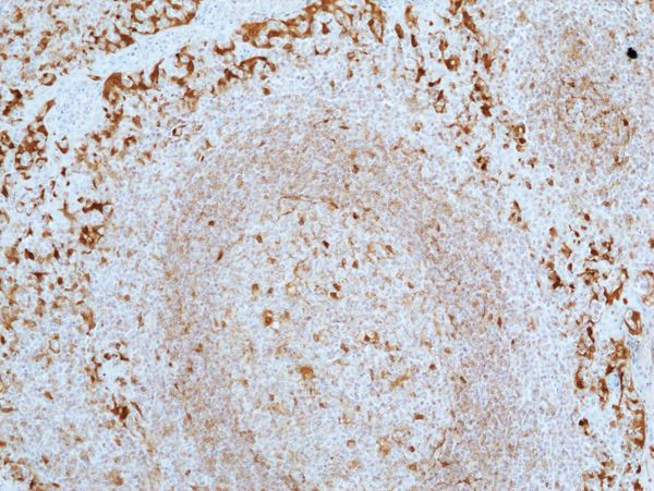 Galectin 9 Antibody in Immunohistochemistry (Paraffin) (IHC (P))