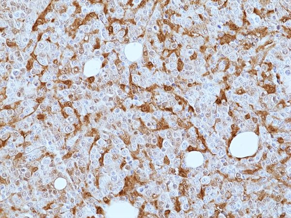 Galectin 9 Antibody in Immunohistochemistry (Paraffin) (IHC (P))