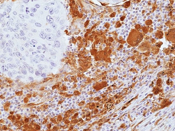 Galectin 9 Antibody in Immunohistochemistry (Paraffin) (IHC (P))