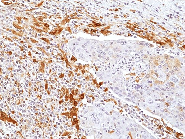 Galectin 9 Antibody in Immunohistochemistry (Paraffin) (IHC (P))