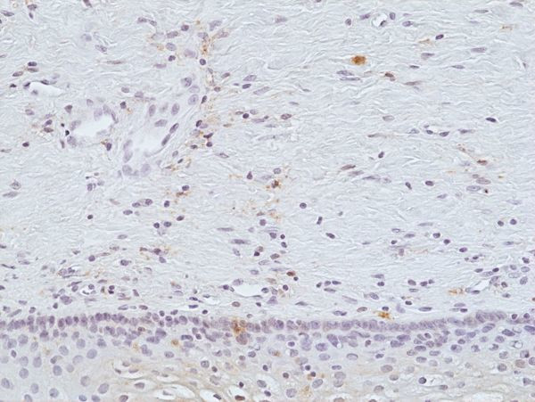 Galectin 9 Antibody in Immunohistochemistry (Paraffin) (IHC (P))