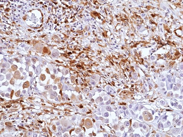 Galectin 9 Antibody in Immunohistochemistry (Paraffin) (IHC (P))