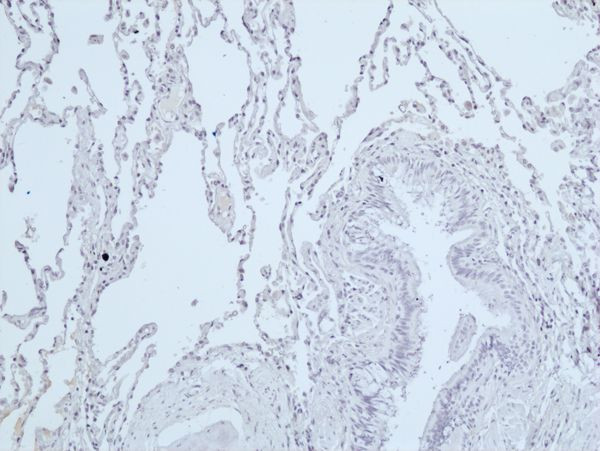 Phospho-DNA-PK (Ser2056) Antibody in Immunohistochemistry (Paraffin) (IHC (P))