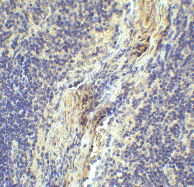 CD223 Antibody in Immunohistochemistry (Paraffin) (IHC (P))