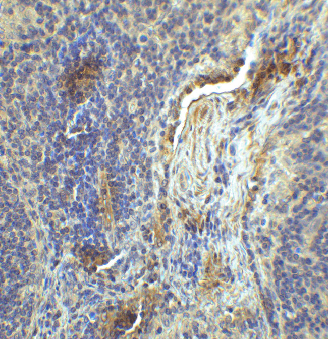 CD223 Antibody in Immunohistochemistry (Paraffin) (IHC (P))