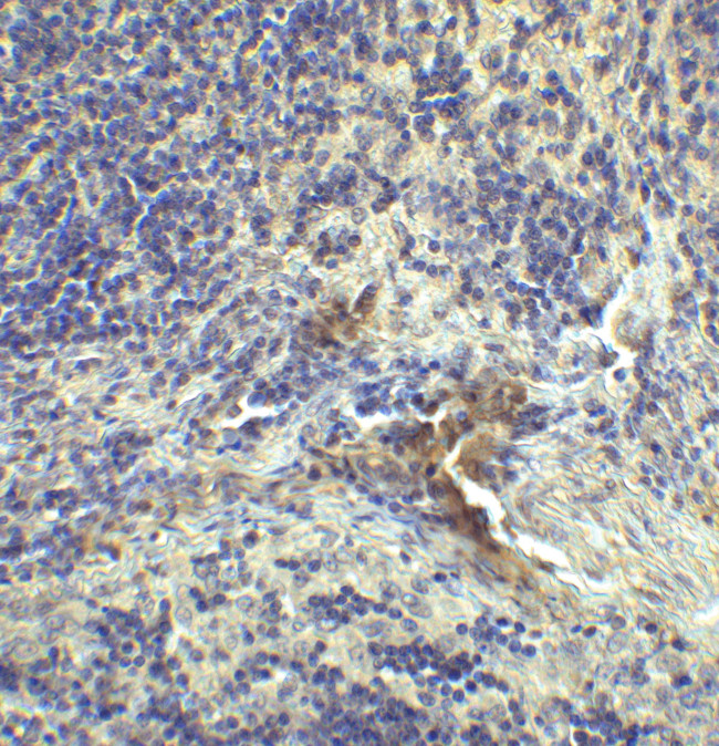 CD223 Antibody in Immunohistochemistry (Paraffin) (IHC (P))