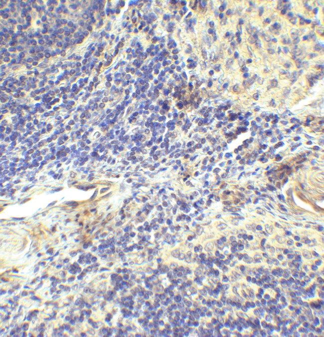 CD223 Antibody in Immunohistochemistry (Paraffin) (IHC (P))