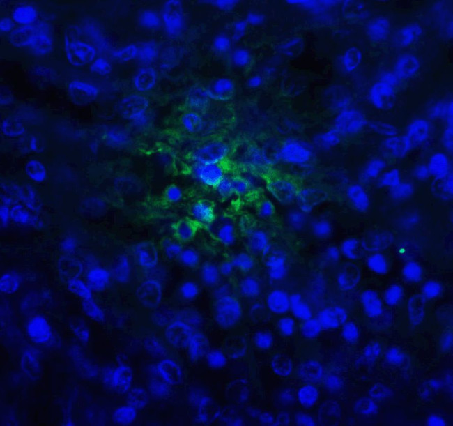 TIGIT Antibody in Immunohistochemistry (Paraffin) (IHC (P))