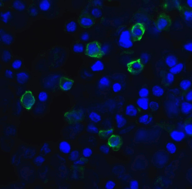 TIGIT Antibody in Immunocytochemistry (ICC/IF)