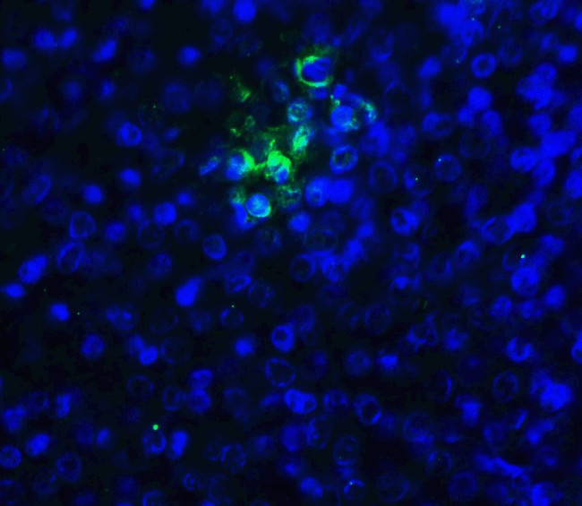 TIGIT Antibody in Immunohistochemistry (Paraffin) (IHC (P))