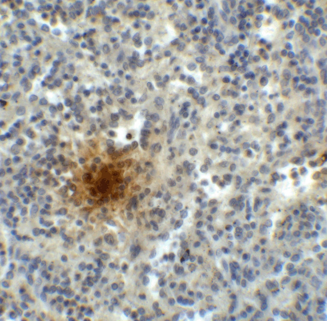 TIGIT Antibody in Immunohistochemistry (Paraffin) (IHC (P))