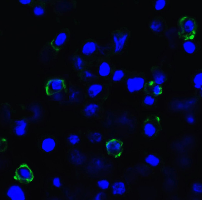 TIGIT Antibody in Immunocytochemistry (ICC/IF)