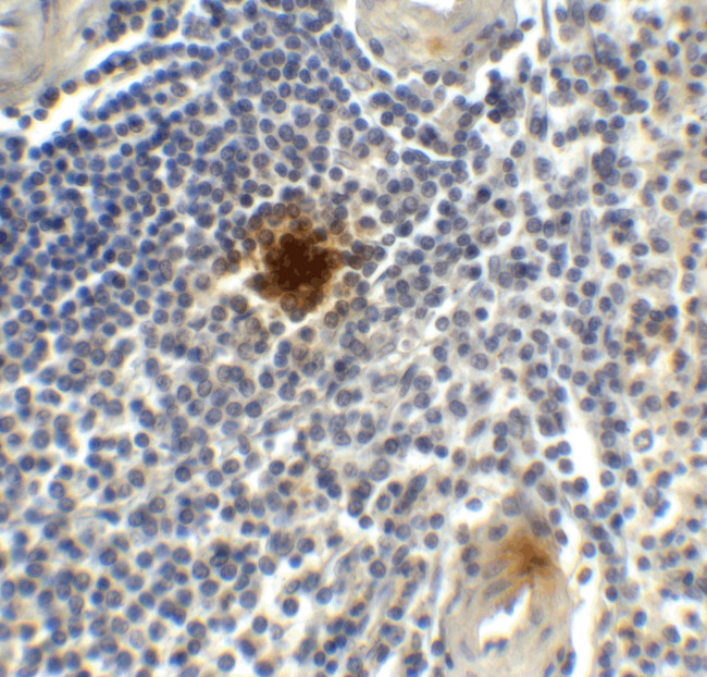 TIGIT Antibody in Immunohistochemistry (Paraffin) (IHC (P))