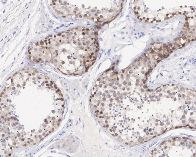 CRBN Antibody in Immunohistochemistry (Paraffin) (IHC (P))